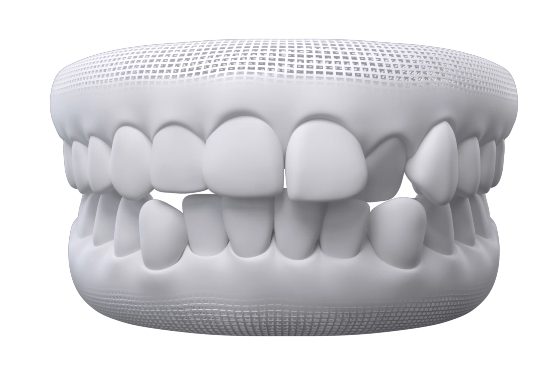 Alinhamento geral dos dentes