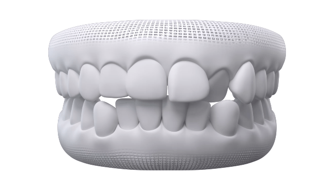 Alinhamento geral dos dentes