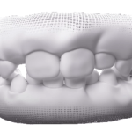 Dentes de leite e permanentes