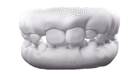 Dentes de leite e permanentes.